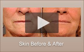 La Jolla Skin Resurfacing Specialist